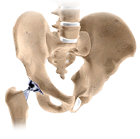  Hip Arthroscopy